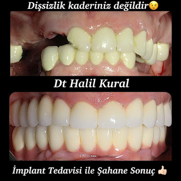 Slider image (6) Dr. Halil Kural